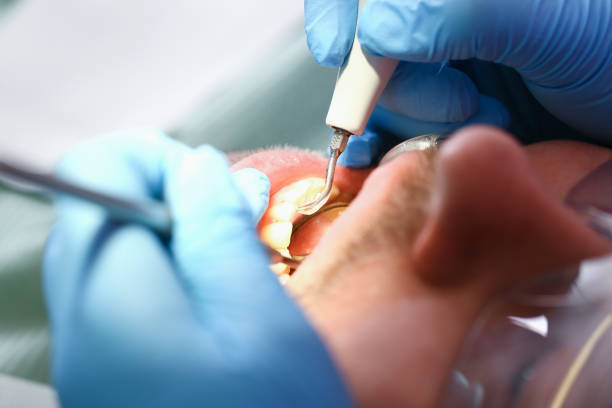 Best Mobile Emergency Dentist in Mead, WA