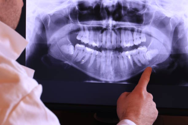 Best Weekend Emergency Dentist in Mead, WA